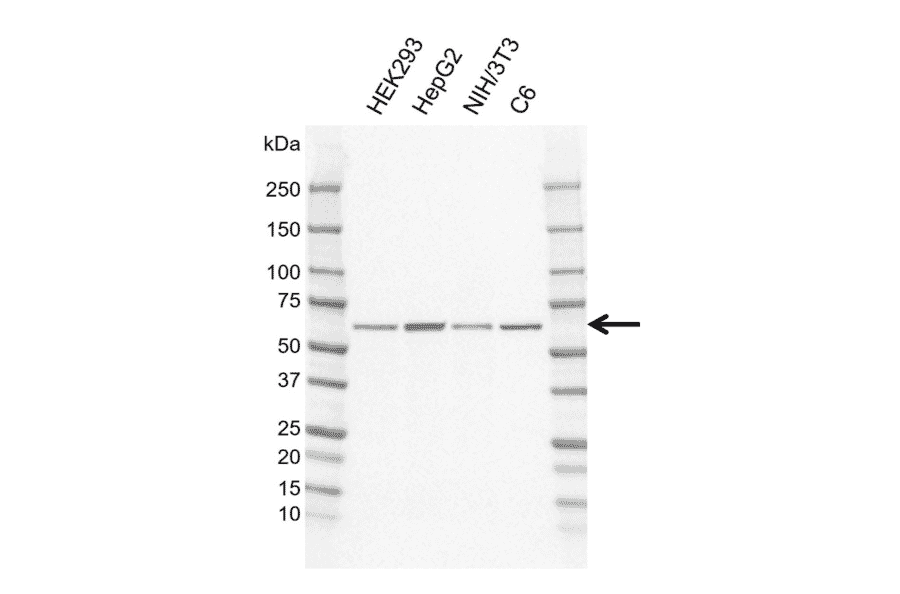 Western Blot - Anti-Frizzled 5 Antibody [CD02-3B3] (A320302) - Antibodies.com