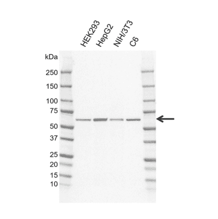 Western Blot - Anti-Frizzled 5 Antibody [CD02-3B3] (A320302) - Antibodies.com