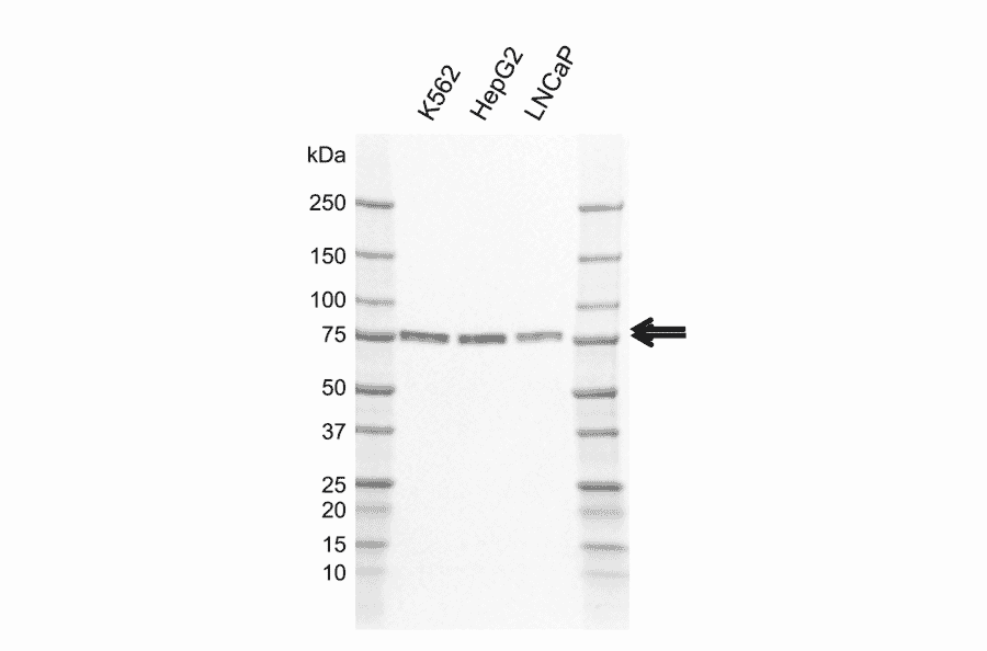 Western Blot - Anti-CAMKK2 Antibody [AB01/3H6] (A320308) - Antibodies.com