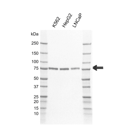 Western Blot - Anti-CAMKK2 Antibody [AB01/3H6] (A320308) - Antibodies.com