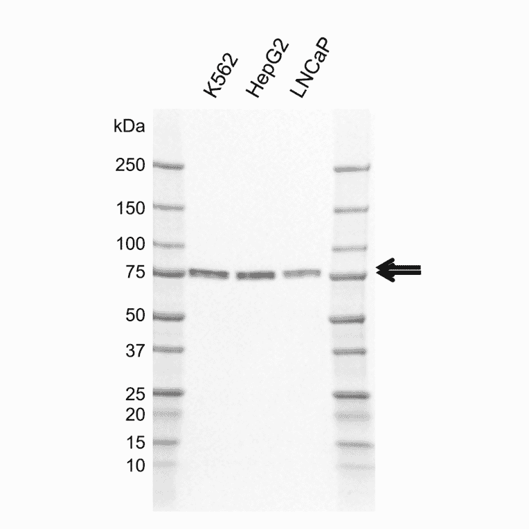 Western Blot - Anti-CAMKK2 Antibody [AB01/3H6] (A320308) - Antibodies.com