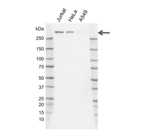 Western Blot - Anti-Nuclear Receptor Corepressor NCoR Antibody [J02/11D2-8] (A320310) - Antibodies.com