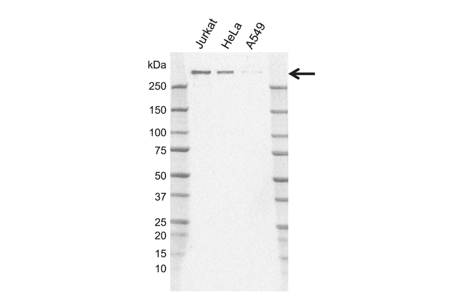 Western Blot - Anti-Nuclear Receptor Corepressor NCoR Antibody [J02/11D2-8] (A320310) - Antibodies.com