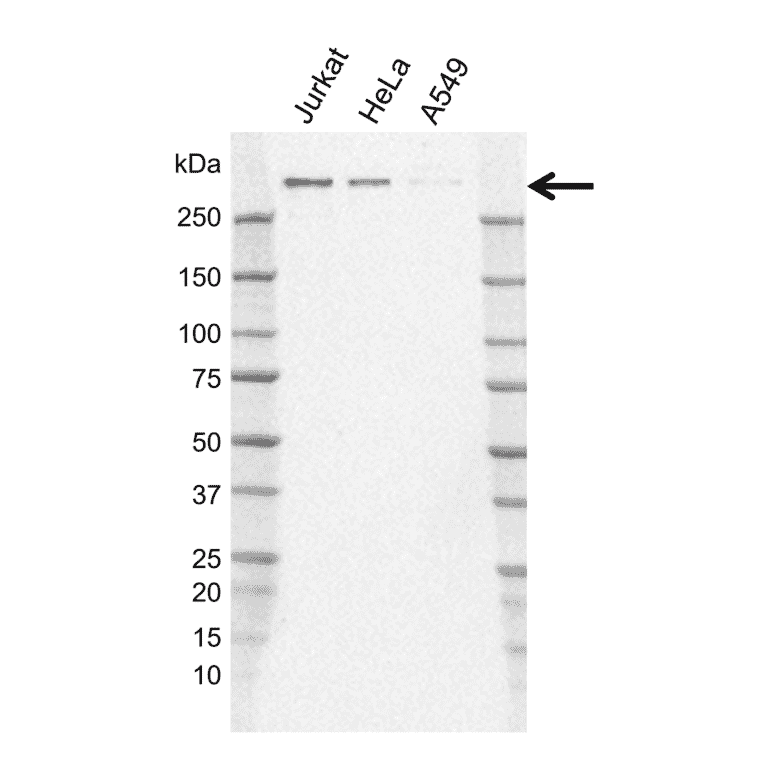 Western Blot - Anti-Nuclear Receptor Corepressor NCoR Antibody [J02/11D2-8] (A320310) - Antibodies.com