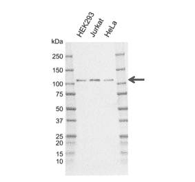 Western Blot - Anti-CYLD Antibody [CD02/3E12-1] (A320311) - Antibodies.com