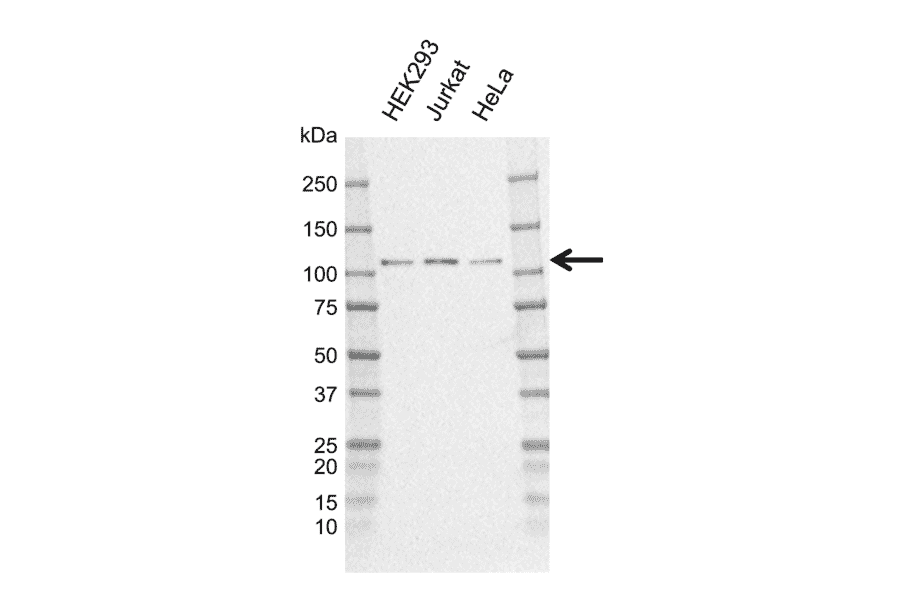 Western Blot - Anti-CYLD Antibody [CD02/3E12-1] (A320311) - Antibodies.com