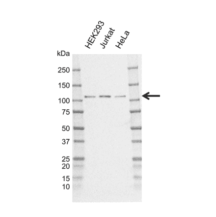 Western Blot - Anti-CYLD Antibody [CD02/3E12-1] (A320311) - Antibodies.com