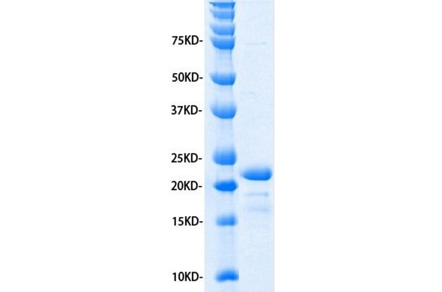 SDS-PAGE - Recombinant Human IL-11 Protein (A320484) - Antibodies.com
