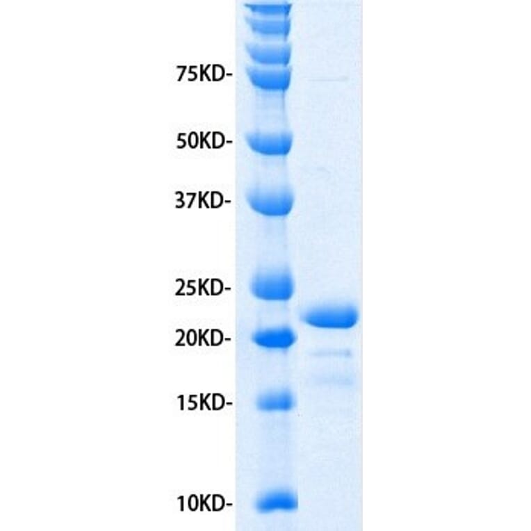 SDS-PAGE - Recombinant Human IL-11 Protein (A320484) - Antibodies.com