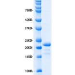SDS-PAGE - Recombinant Human IL-11 Protein (A320484) - Antibodies.com