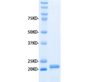 SDS-PAGE - Recombinant Human MMP3 Protein (A320485) - Antibodies.com