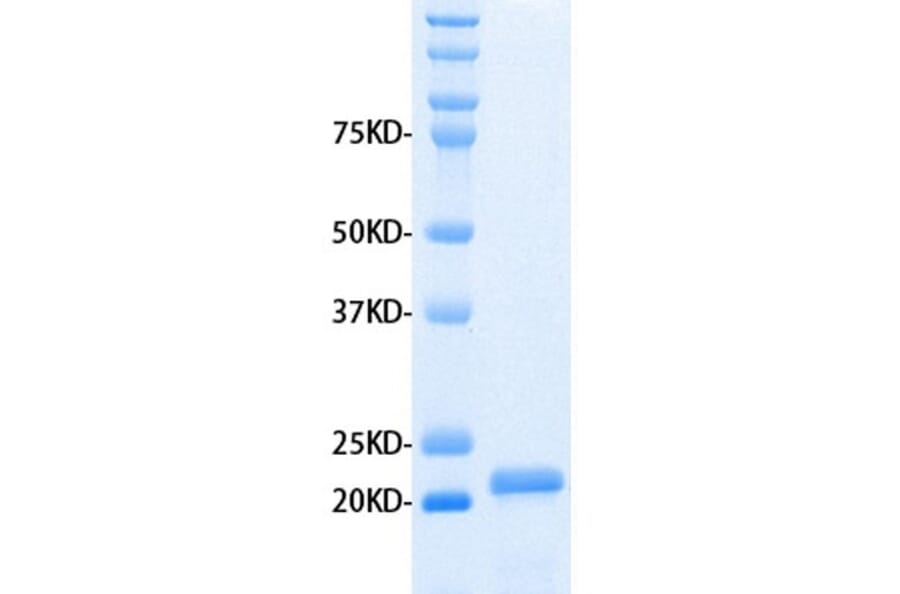 SDS-PAGE - Recombinant Human MMP3 Protein (A320485) - Antibodies.com