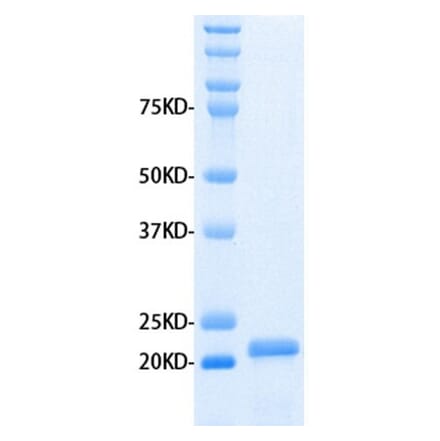 SDS-PAGE - Recombinant Human MMP3 Protein (A320485) - Antibodies.com