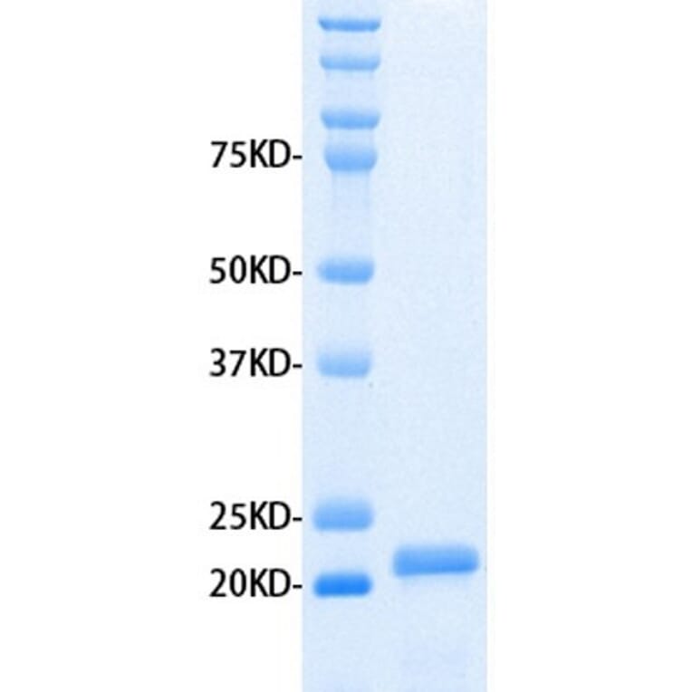 SDS-PAGE - Recombinant Human MMP3 Protein (A320485) - Antibodies.com