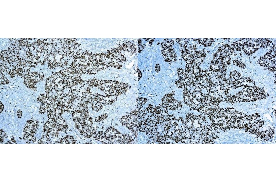 Immunohistochemistry - 30 Minute IHC DAB Detection System (A320597) - Antibodies.com