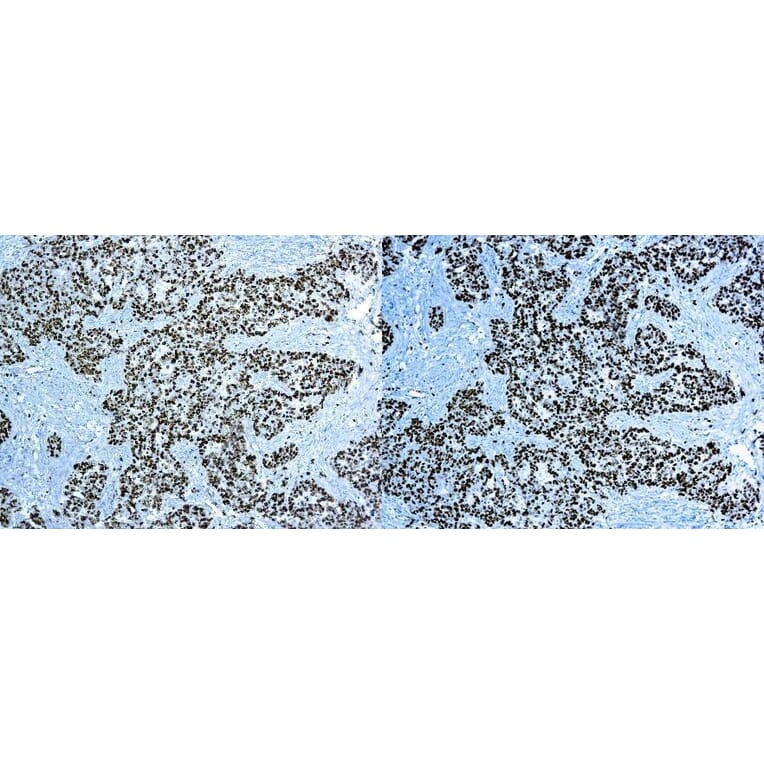 Immunohistochemistry - 30 Minute IHC DAB Detection System (A320597) - Antibodies.com