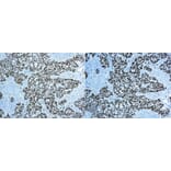 Immunohistochemistry - 30 Minute IHC DAB Detection System (A320597) - Antibodies.com