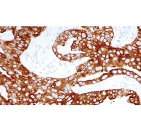 Immunohistochemistry - Anti-Cytokeratin 8 Antibody [TS1] (A320598) - Antibodies.com