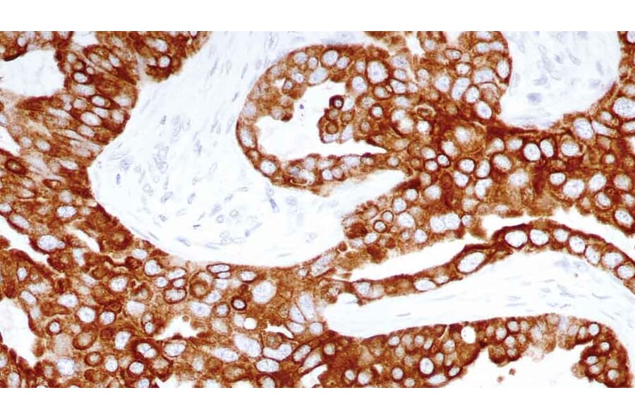 Immunohistochemistry - Anti-Cytokeratin 8 Antibody [TS1] (A320598) - Antibodies.com