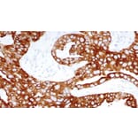 Immunohistochemistry - Anti-Cytokeratin 8 Antibody [TS1] (A320598) - Antibodies.com