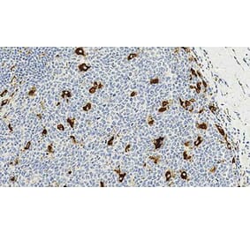 Immunohistochemistry - Anti-CD68 Antibody [514H12] (A320599) - Antibodies.com
