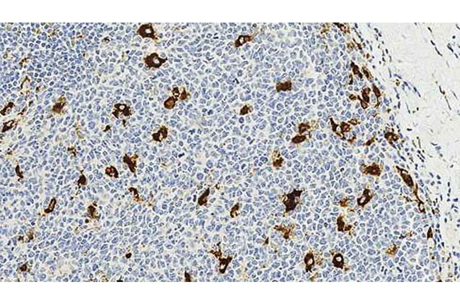 Immunohistochemistry - Anti-CD68 Antibody [514H12] (A320599) - Antibodies.com