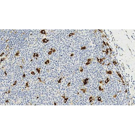 Immunohistochemistry - Anti-CD68 Antibody [514H12] (A320599) - Antibodies.com