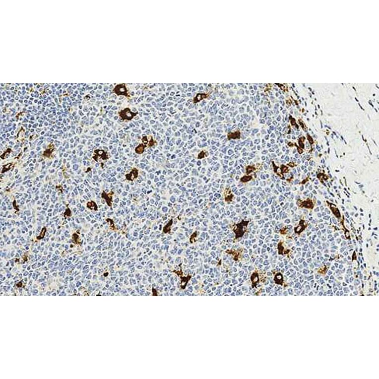 Immunohistochemistry - Anti-CD68 Antibody [514H12] (A320599) - Antibodies.com