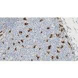 Immunohistochemistry - Anti-CD68 Antibody [514H12] (A320599) - Antibodies.com