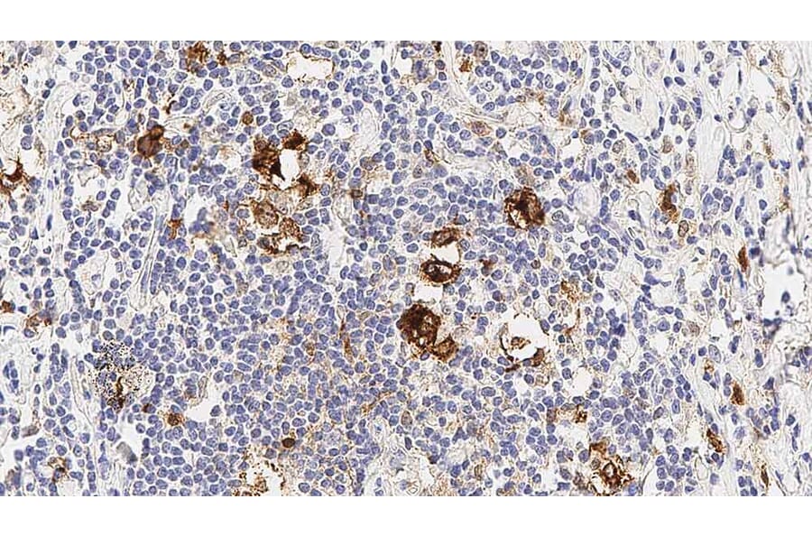 Immunohistochemistry - Anti-CD30 Antibody [JCM182] (A320603) - Antibodies.com
