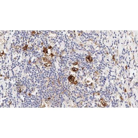 Immunohistochemistry - Anti-CD30 Antibody [JCM182] (A320603) - Antibodies.com