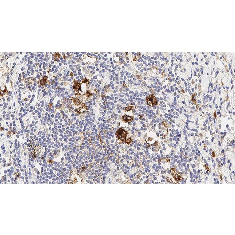 Immunohistochemistry - Anti-CD30 Antibody [JCM182] (A320603) - Antibodies.com