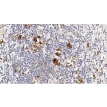 Immunohistochemistry - Anti-CD30 Antibody [JCM182] (A320603) - Antibodies.com
