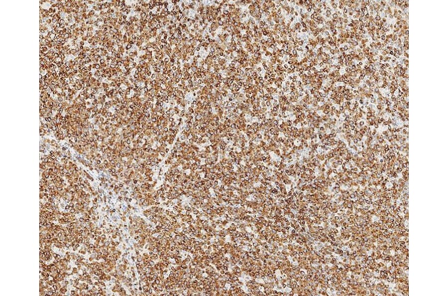 Immunohistochemistry - Anti-Bcl-2 Antibody [bcl-2/100/D5] (A320604) - Antibodies.com