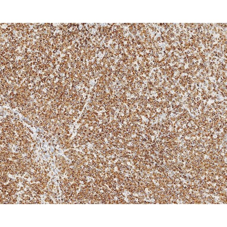Immunohistochemistry - Anti-Bcl-2 Antibody [bcl-2/100/D5] (A320604) - Antibodies.com
