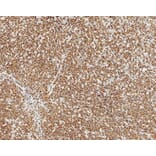 Immunohistochemistry - Anti-Bcl-2 Antibody [bcl-2/100/D5] (A320604) - Antibodies.com