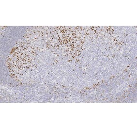 Immunohistochemistry - Anti-MUM-1 Antibody [EAU32] (A320605) - Antibodies.com