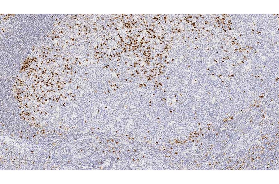 Immunohistochemistry - Anti-MUM-1 Antibody [EAU32] (A320605) - Antibodies.com