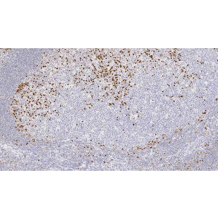 Immunohistochemistry - Anti-MUM-1 Antibody [EAU32] (A320605) - Antibodies.com