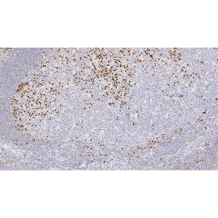 Immunohistochemistry - Anti-MUM-1 Antibody [EAU32] (A320605) - Antibodies.com