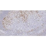 Immunohistochemistry - Anti-MUM-1 Antibody [EAU32] (A320605) - Antibodies.com