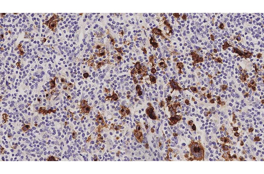 Immunohistochemistry - Anti-CD15 Antibody [MMA] (A320606) - Antibodies.com