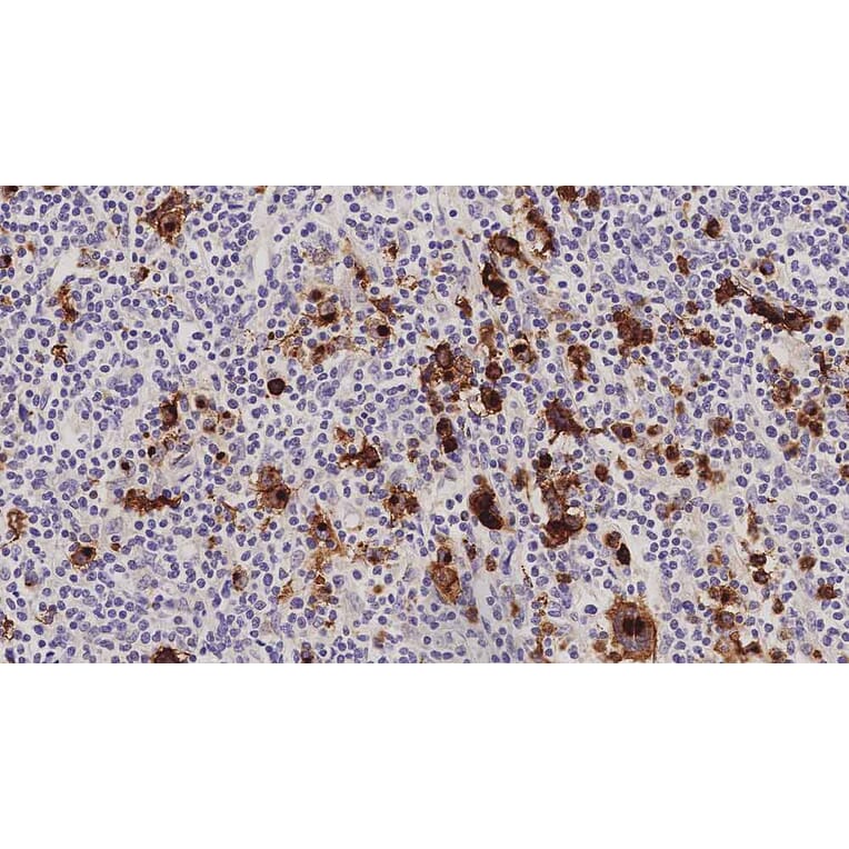 Immunohistochemistry - Anti-CD15 Antibody [MMA] (A320606) - Antibodies.com