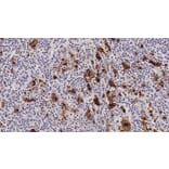 Immunohistochemistry - Anti-CD15 Antibody [MMA] (A320606) - Antibodies.com