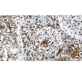 Immunohistochemistry - Anti-CD45RO Antibody [UCHL1] (A320608) - Antibodies.com
