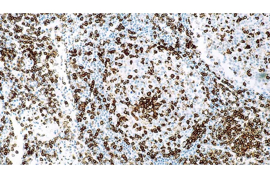 Immunohistochemistry - Anti-CD45RO Antibody [UCHL1] (A320608) - Antibodies.com