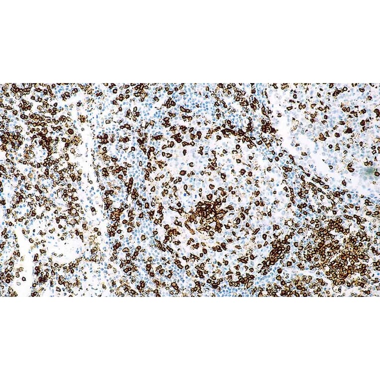 Immunohistochemistry - Anti-CD45RO Antibody [UCHL1] (A320608) - Antibodies.com