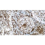 Immunohistochemistry - Anti-CD45RO Antibody [UCHL1] (A320608) - Antibodies.com