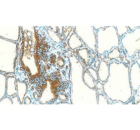 Immunohistochemistry - Anti-Thyroglobulin Antibody [1D4] (A320609) - Antibodies.com