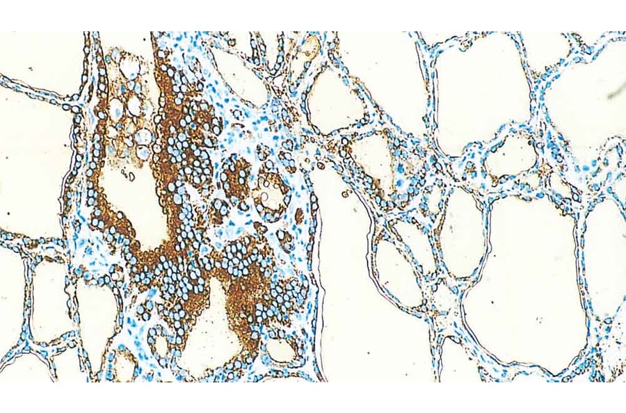 Immunohistochemistry - Anti-Thyroglobulin Antibody [1D4] (A320609) - Antibodies.com